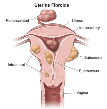 uterine layers